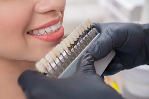 What To Do If Dental Veneers Come Off